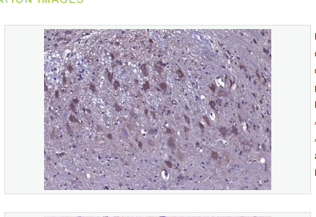 Anti-CACNA1G antibody-电压依赖性钙通道Cav3.1抗体,CACNA1G