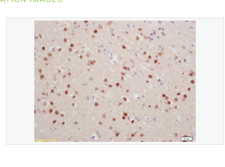 Anti-phospho-Histone H1.4 antibody-磷酸化组蛋白H1.4抗体,phospho-Histone H1.4 (Thr18)