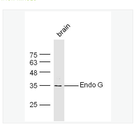 Anti-Endo G antibody-核酸内切酶G抗体,Endo G