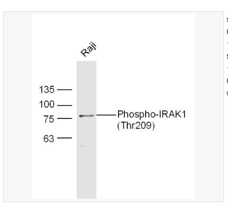 Anti-Phospho-IRAK1 antibody-磷酸化白介素-1受体相关激酶1抗体,Phospho-IRAK1 (Thr209)