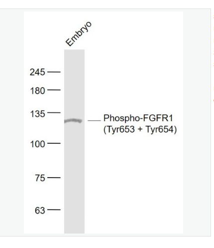 Anti-Phospho-FGFR1 antibody-磷酸化碱性成纤维细胞生长因子受体1（CD331）抗体,Phospho-FGFR1 (Tyr653 + Tyr654)