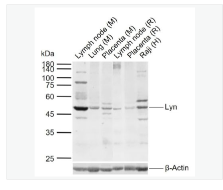 Anti-Lyn  antibody-膜相关蛋白酪氨酸激酶Lyn抗体,Lyn