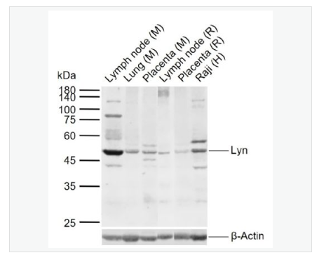 Anti-Lyn  antibody-膜相關(guān)蛋白酪氨酸激酶Lyn抗體,Lyn