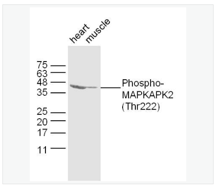 Anti-Phospho-MAPKAPK2  antibody-磷酸化丝裂原活化蛋白激酶活化的蛋白激酶2抗体,Phospho-MAPKAPK2 (Thr222)