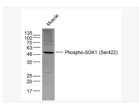 Anti-Phospho-SGK1 antibody-磷酸化糖皮质激素调节激酶1抗体,Phospho-SGK1 (Ser422)