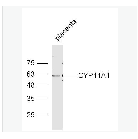 Anti-CYP11A1 antibody-细胞色素P450 11A1抗体,CYP11A1