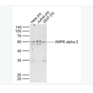 Anti-AMPK alpha 2  antibody-腺苷单磷酸活化蛋白激酶α2抗体