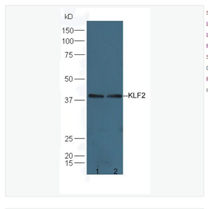 Anti-KLF2 antibody-肺Kruppel样因子抗体