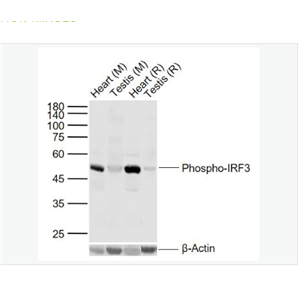 Anti-Phospho-IRF3 antibody-磷酸化干扰素调节因子3