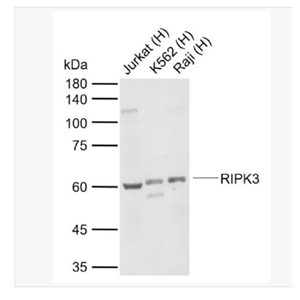 Anti-RIPK3 antibody-受体结合丝氨酸苏氨酸激酶3抗体,RIPK3