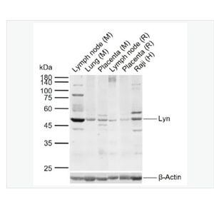 Anti-Lyn  antibody-膜相关蛋白酪氨酸激酶Lyn抗体