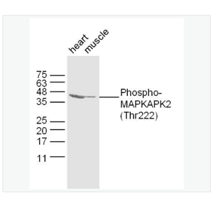 Anti-Phospho-MAPKAPK2  antibody-磷酸化丝裂原活化蛋白激酶活化的蛋白激酶2抗体