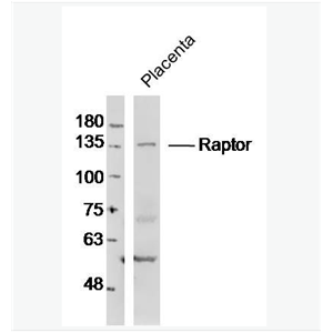 Anti-Raptor antibody-mTOR相关调控蛋白抗体