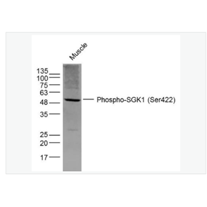 Anti-Phospho-SGK1 antibody-磷酸化糖皮质激素调节激酶1抗体,Phospho-SGK1 (Ser422)