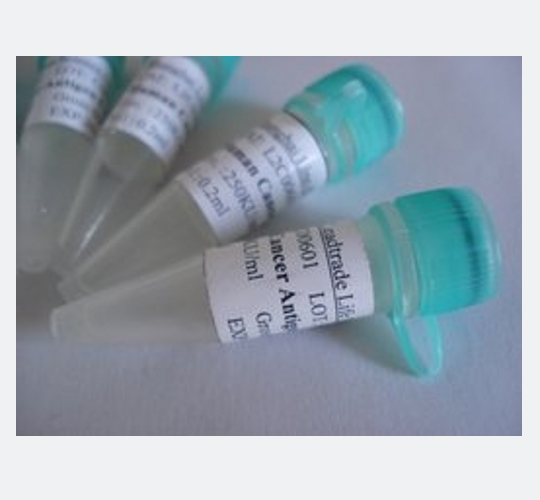 周期素依賴性激酶11蛋白,CDK11 Protein