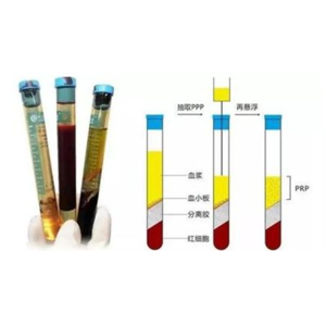 低析出分离胶,Serum Separtion Gel For PRP Tube