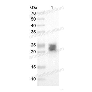 抗体：Monkeypox virus/MPXV M1R Antibody (SAA0284) RVV13302