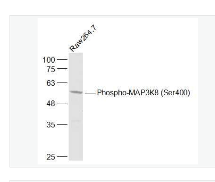 Anti-Phospho-MAP3K  antibody-磷酸化丝裂原活化蛋白激酶激酶8抗体,Phospho-MAP3K8 (Ser400)