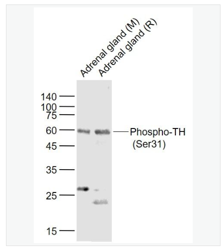 Anti-Phospho-TH  antibody-磷酸化酪氨酸羟化酶抗体,Phospho-TH (Ser31)