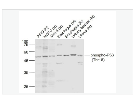 Anti-phospho-P53   antibody-磷酸化肿瘤抑制基因P53抗体,phospho-P53 (Thr18)