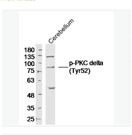 Anti-phospho-PKC delta   antibody-磷酸化蛋白激酶C亚性D型抗体,phospho-PKC delta (Tyr52)