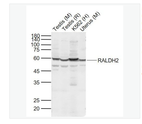 Anti-RALDH2 antibody-视黄醛脱氢酶2型抗体,RALDH2