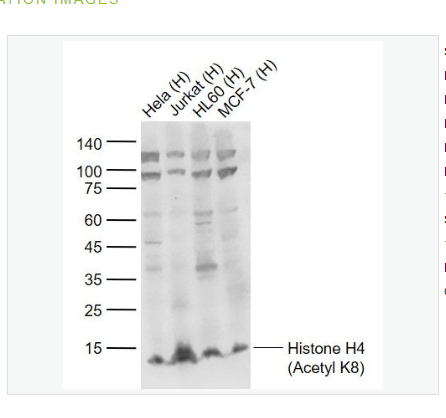 Anti-Histone H4 antibody-乙?；M蛋白H4抗體,Histone H4 (Acetyl K8)