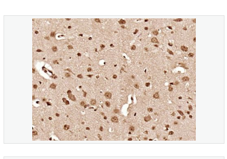 Anti-Hsc70 antibody-熱休克蛋白71抗體,Hsc70