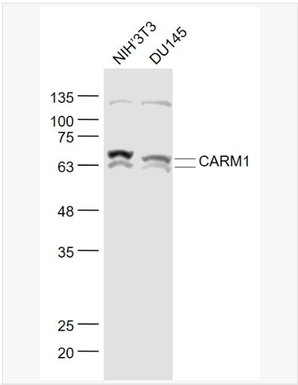 Anti-CARM1 antibody-蛋白精氨酸N甲基4抗体,CARM1