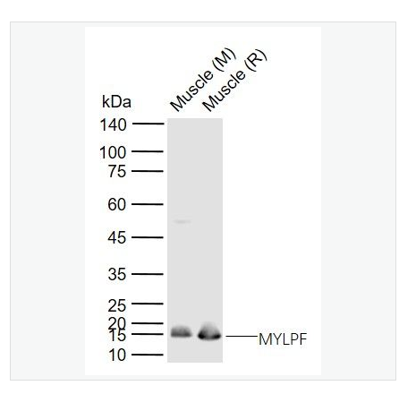 Anti-MYLPF antibody-快速骨骼肌肌球蛋白轻链2抗体,MYLPF