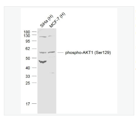 Anti-phospho-AKT1 antibody-磷酸化蛋白激酶B抗体,phospho-AKT1 (Ser129)