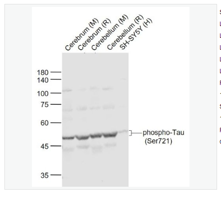 Anti-phospho-Tau antibody-磷酸化微管相关蛋白抗体,phospho-Tau (Ser721)