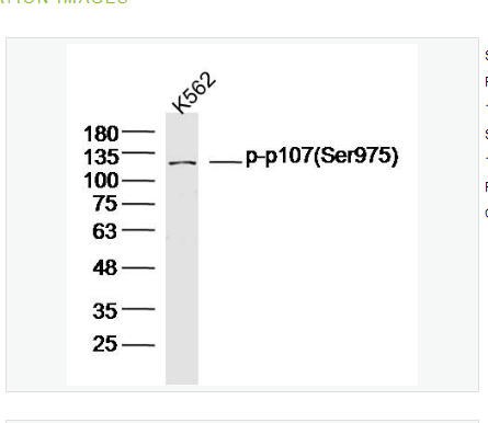 Anti-phospho-p107 antibody-磷酸化视网膜母细胞瘤样蛋白p107抗体,Phophospho-p107 (Ser975)