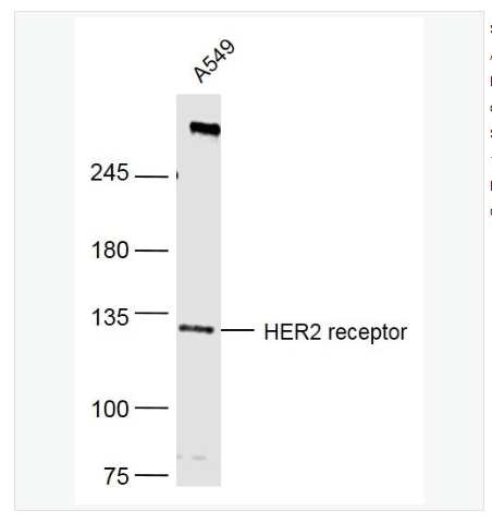 Anti-HER2 receptor  antibody-HER2受体单克隆抗体,HER2 receptor