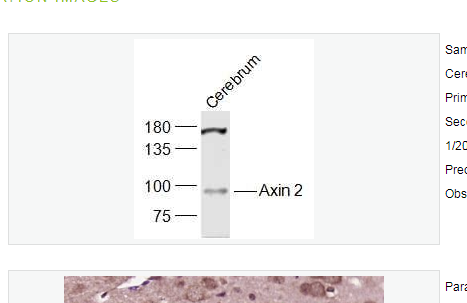 Anti-Axin 2 antibody-轴抑制蛋白2抗体,Axin 2