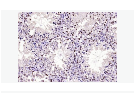 Anti-STK36 antibody-丝氨酸/苏氨酸激酶36融合同源蛋白抗体,STK36