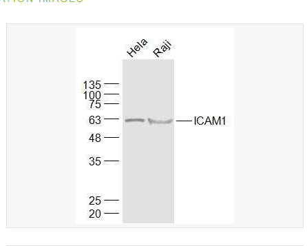 Anti-ICAM1 antibody-细胞间粘附分子1（CD54）抗体,ICAM1