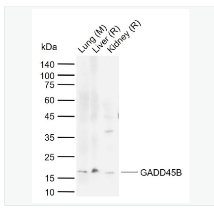 Anti-GADD45B antibody-生长抑制DNA损伤基因GADD45β抗体,GADD45B