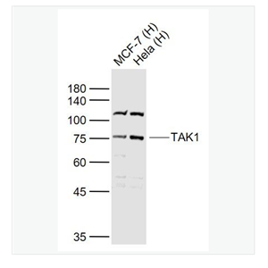 Anti-TAK1 antibody-转化生长因子β活化激酶1