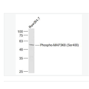 Anti-Phospho-MAP3K  antibody-磷酸化丝裂原活化蛋白激酶激酶8抗体