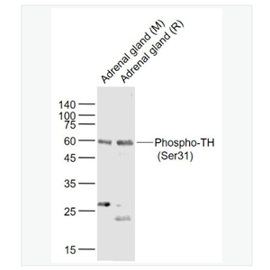 Anti-Phospho-TH  antibody-磷酸化酪氨酸羥化酶抗體