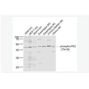 Anti-phospho-P53   antibody-磷酸化肿瘤抑制基因P53抗体