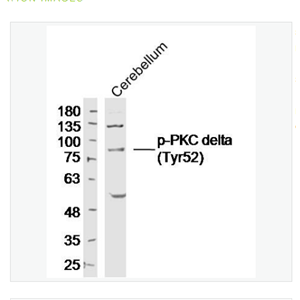 Anti-phospho-PKC delta   antibody-磷酸化蛋白激酶C亚性D型抗体