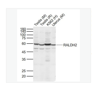 Anti-RALDH2 antibody-视黄醛脱氢酶2型抗体,RALDH2
