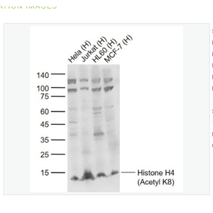 Anti-Histone H4 antibody-乙酰化組蛋白H4抗體,Histone H4 (Acetyl K8)