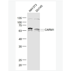 Anti-CARM1 antibody-蛋白精氨酸N甲基4抗体,CARM1