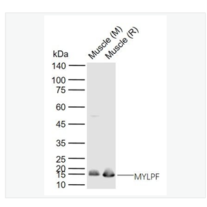 Anti-MYLPF antibody-快速骨骼肌肌球蛋白轻链2抗体