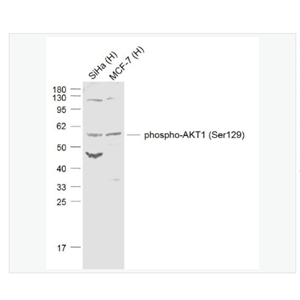 Anti-phospho-AKT1 antibody-磷酸化蛋白激酶B抗体