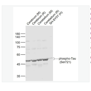 Anti-phospho-Tau antibody-磷酸化微管相关蛋白抗体,phospho-Tau (Ser721)