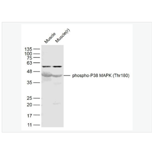Anti-phospho-P38 MAPK antibody-磷酸化p38MAPK抗体,phospho-P38 MAPK (Thr180)